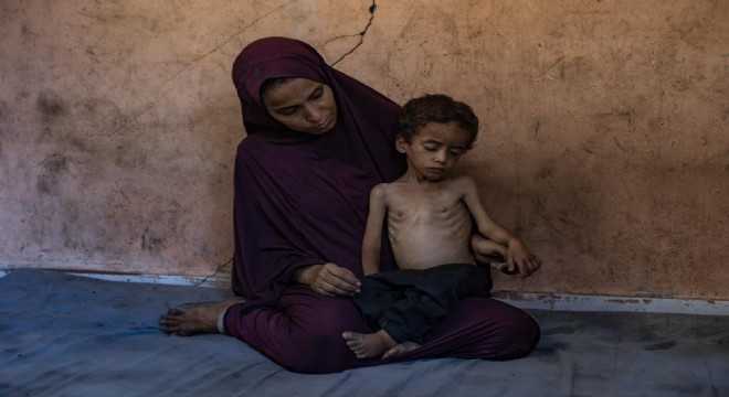 Gazze'de açlıktan ölenlerin sayısı 113'e yükseldi